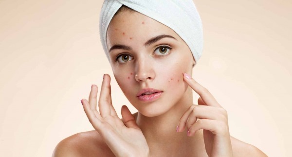 Acne - What is it, how to get rid of pimples on the face. Drugs, diet laser treatments, mesotherapy