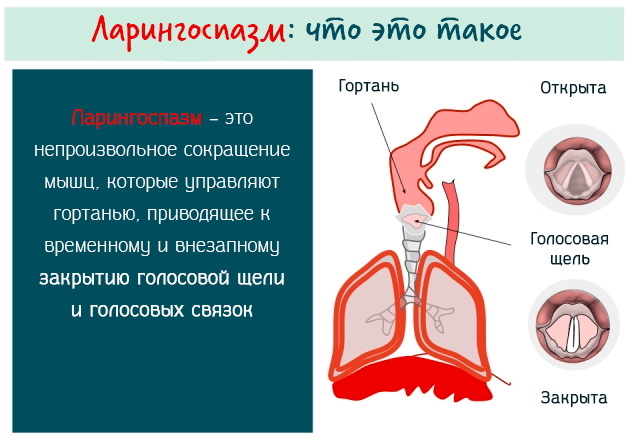 Laryngospasme hos voksne. Symptomer og behandling