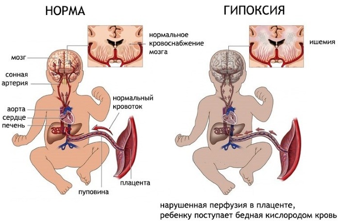 Pilvo dekompresija nėštumo metu. Kas tai yra, indikacijos ir kontraindikacijos