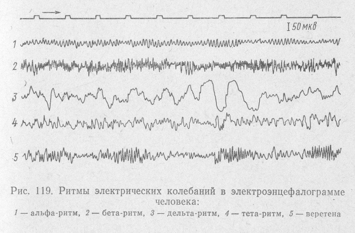 Vaikų elektroencefalografija (EEG). Norma ir pažeidimai, dekodavimas