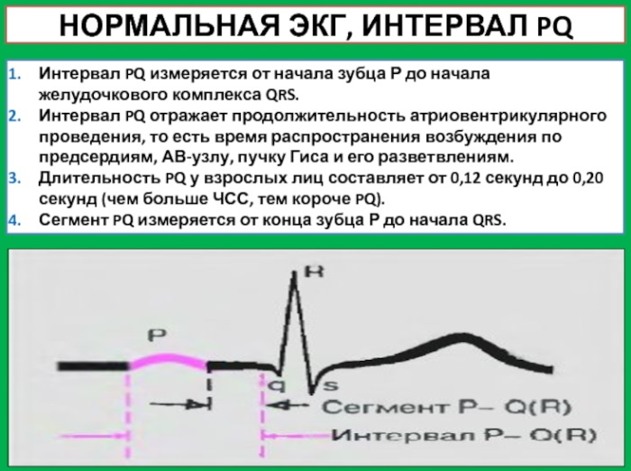 QRS komplex EKG: norma, tachycardia, amely keskeny, széles qrs -t, időtartamot tükröz