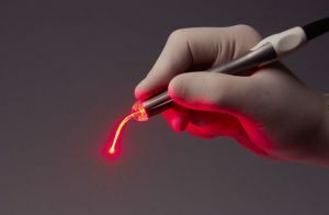 používanie laseru v ortopédii