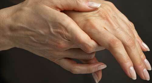 The first symptoms of rheumatoid arthritis of the fingers