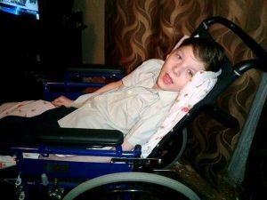 manifestations of cerebral palsy