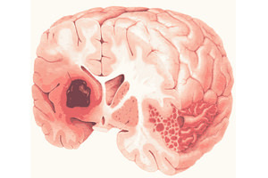 hjerne