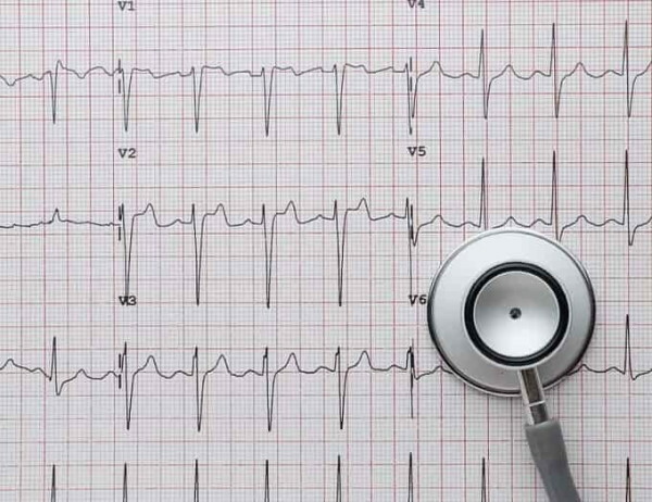 Sådan læser du hjertets elektrokardiogram. EKG -afkodning