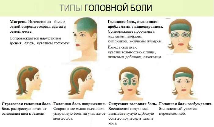 Headache in the forehead. Reasons, which means treatment, psychosomatics