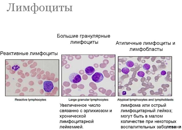 Atypical lymphocytes in the blood test in adults, children are lowered, increased. What does it mean, the norm