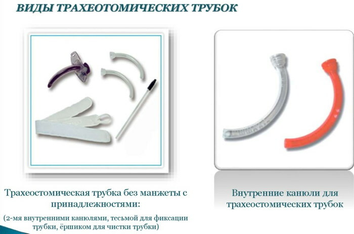 Tracheostomy: a set of instruments, technique, types