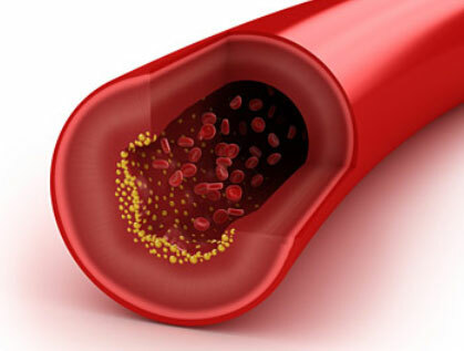 Cómo bajar el colesterol en la sangre