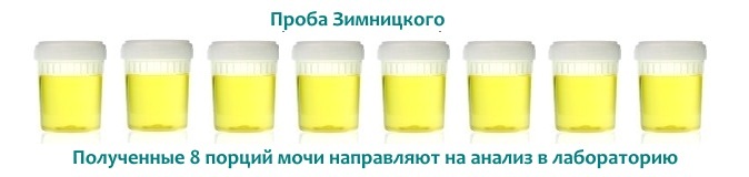Analiza urinară a lui Zimnitsky