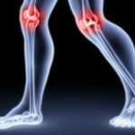 artralgija na kolenih