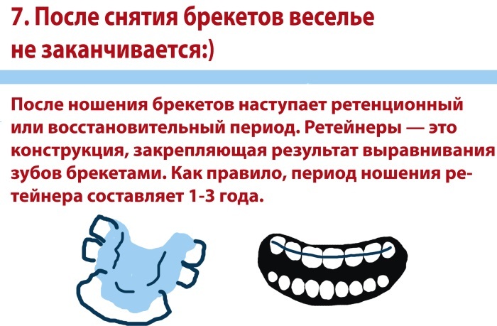 Retainers after braces. Photos, side effects, installation, what they are made of, how to wear, when can you put