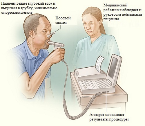 Spirometrija (spirografija). Įprasti rodikliai, lentelė, kaip tai atliekama, rezultatų dekodavimas
