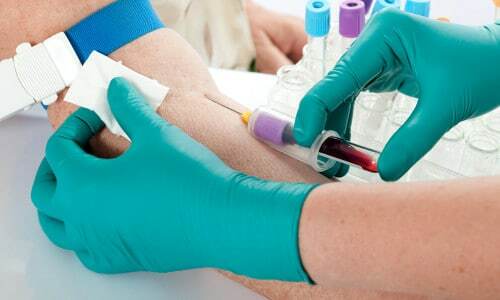 It is necessary to regularly give blood for analysis