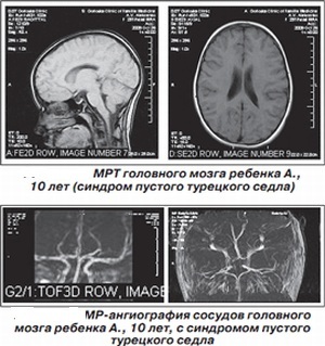 Az idegrendszer betegségeinek diagnosztizálása