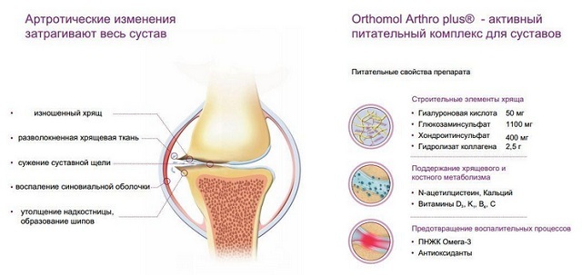 Orthomol arthro plus-sammensætning