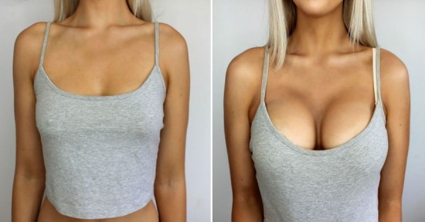 Why do women have small breasts? Causes