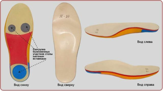 As orthopedic insoles with flat feet should be preferred