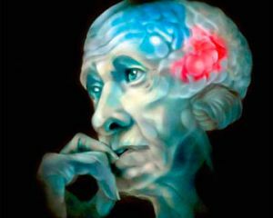 Parkinsons syndrom och tal