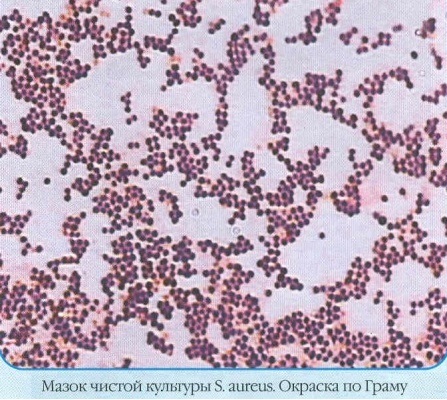 Staphylococcus aureus (Staphylococcus aureus): a garatból származó kenet normája, 10-3-8 fok