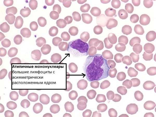 Mononuclear cells in a general blood test. As indicated, what is it, the norm