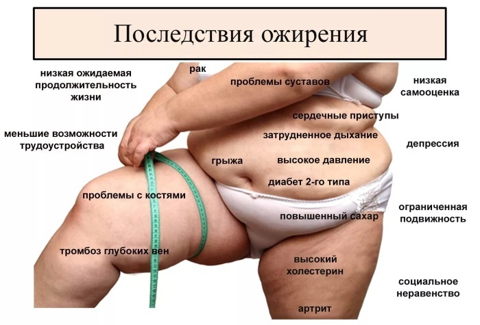 Tabella dell'obesità per le donne per peso, altezza, età. Gradi