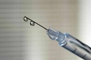 chondroguard injekcijos
