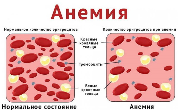 Unchanged red blood cells in the urine. What does it mean, elevated, reasons, norm