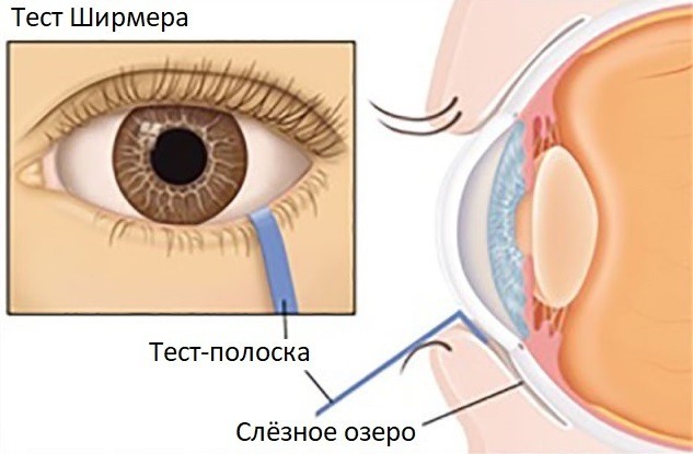 Schirmerio testas oftalmologijoje. Kas tai yra, kaip elgtis, normos