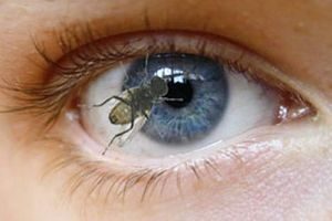 insect in the eye