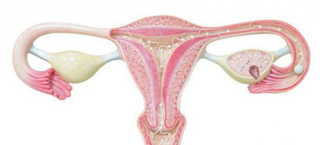 How does the ovarian cyst resolve?