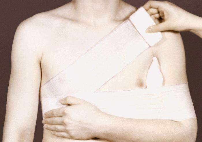 Dezo Bandage, technique of application