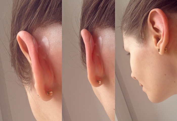 Arilis ear corrector for newborns, adults. Where can I buy