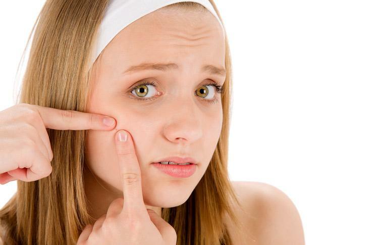 How to remove redness from pimples quickly