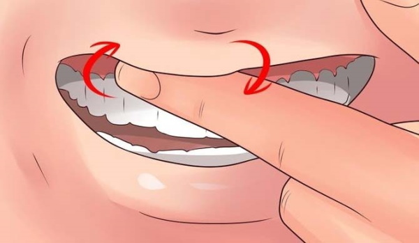 Gums bleed. Home treatment, ointments, tablets, folk remedies