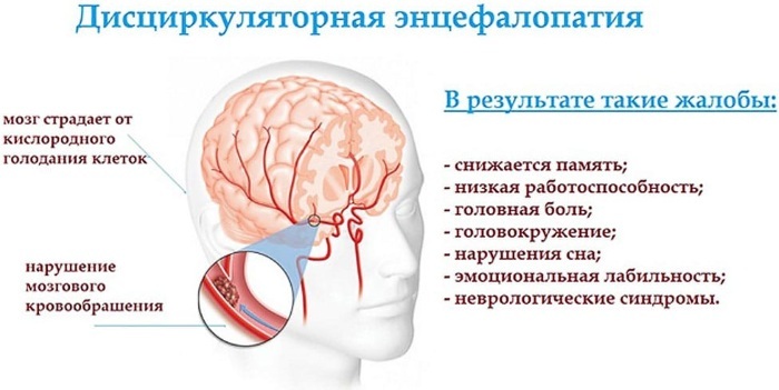 אנצפלופתיה שארית של המוח. מה זה, סימפטומים, אופן הטיפול, השלכות