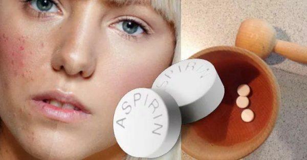 Hvis du bruger en aspirinmaske, bliver akne mindre synlig efter første brug
