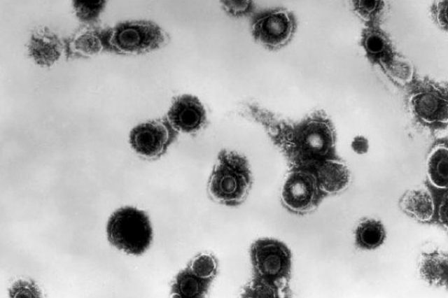 Virus Varicella zoster under the microscope