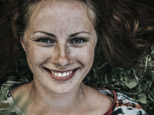 What frees freckles in Russia