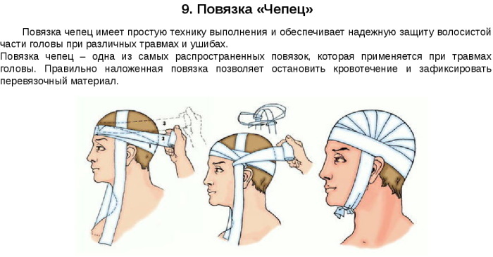 The cap is a band on the head. Algorithm, execution technique, indications