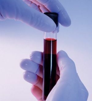 blod biokemi