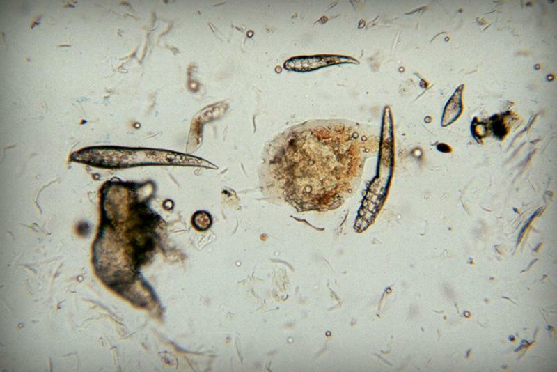 Demodex mite under a microscope