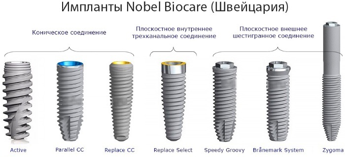 Implantater Nobel Biocare (Nobel Biok Biocare). Totalpris, opprinnelsesland, anmeldelser