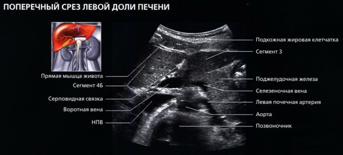 Leversegment på ultraljud, CT, MR -sektioner: diagram, foto