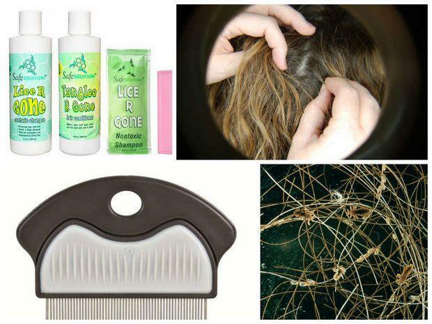 The most effective remedy for lice is a complete list of drugs