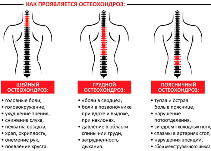 Temperatura para la osteocondrosis de la columna cervical, lumbar y torácica.