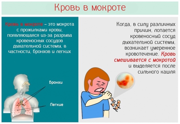 Sputum bloody on expectoration. What can it be, how to treat