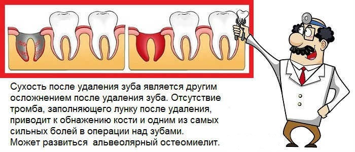 Tooth extraction in the mandible: wisdom, indigenous, destroyed, pregnant, simple, complex. prices