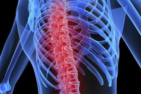 Spondyl means the spine, and osis - disorders